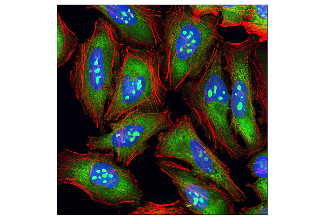 Immunofluorescence Image 1: S6 Ribosomal Protein (54D2) Mouse Monoclonal Antibody (Alexa Fluor<sup>®</sup> 488 Conjugate)