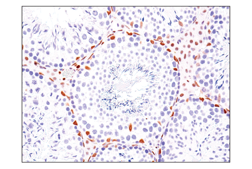 Immunohistochemistry Image 8: TEAD1 (D9X2L) Rabbit Monoclonal Antibody (BSA and Azide Free)