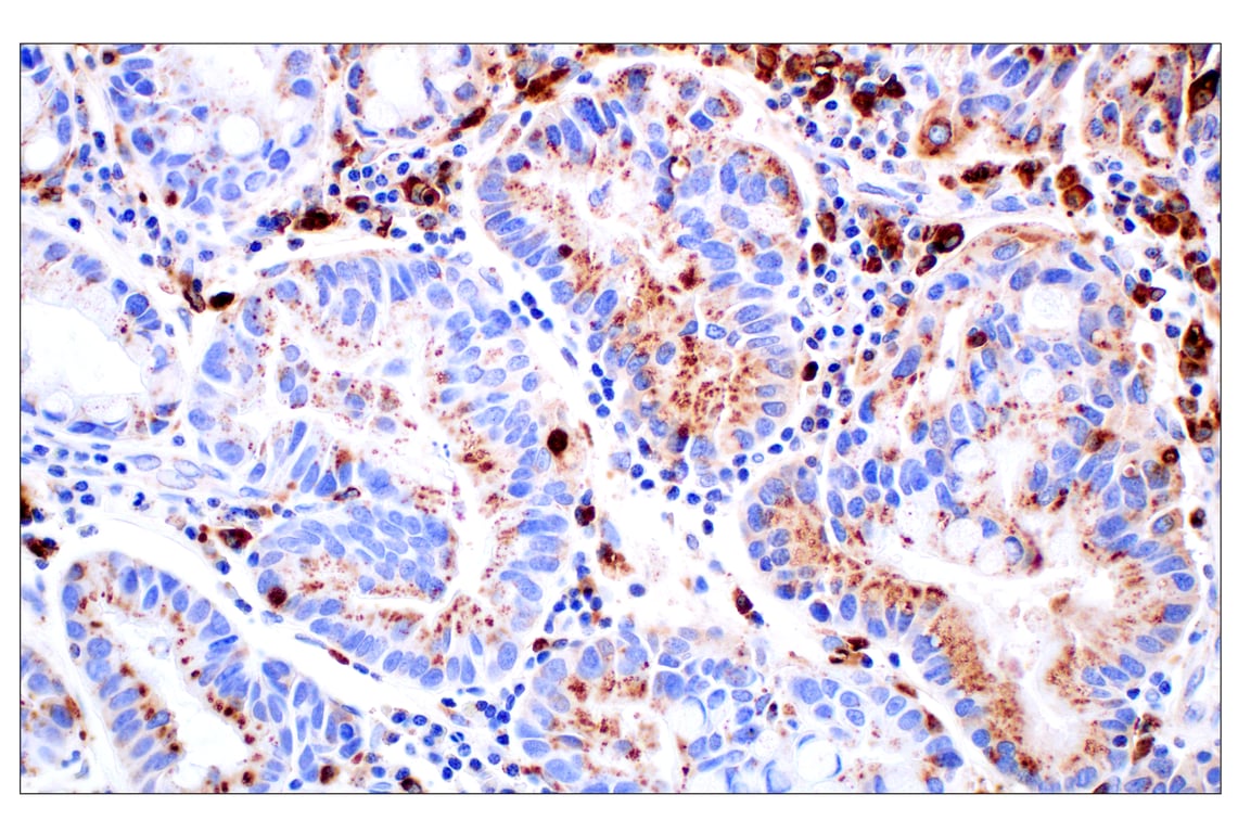 undefined Image 24: Genetics of Parkinson's Disease: Lysosomal Dysfunction Antibody Sampler Kit