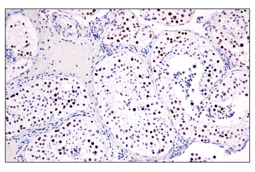 Immunohistochemistry Image 7: ATAD2 (E8Y2K) Rabbit Monoclonal Antibody