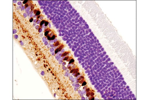 Immunohistochemistry Image 3: Secretagogin (D4V1Y) Rabbit Monoclonal Antibody