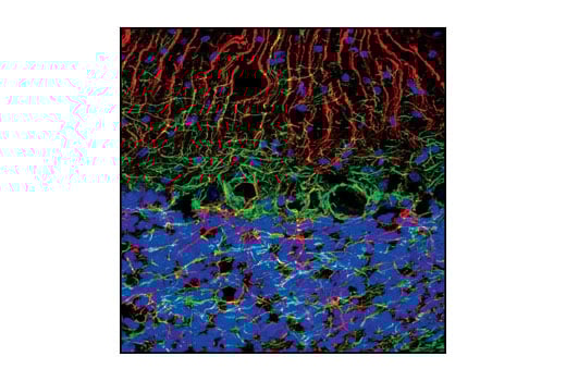 undefined Image 24: Alzheimer's Disease Antibody Sampler Kit