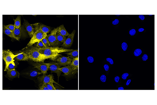 Immunofluorescence Image 1: CD44 (IM7) Rat Monoclonal Antibody (Alexa Fluor<sup>®</sup> 555 Conjugate)