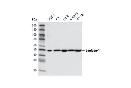 undefined Image 11: Glycolysis II Antibody Sampler Kit