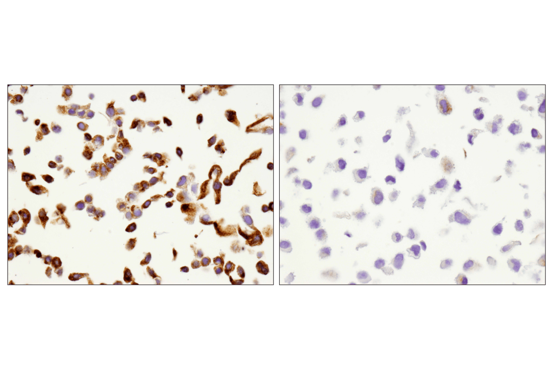 Immunohistochemistry Image 6: VISTA (D1L2G) Rabbit Monoclonal Antibody
