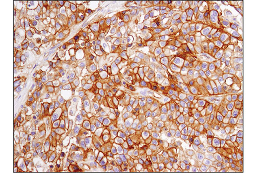 Immunohistochemistry Image 1: PVR/CD155 (D8A5G) Rabbit mAb