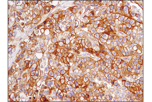 Immunohistochemistry Image 1: PVR/CD155 (D8A5G) Rabbit Monoclonal Antibody