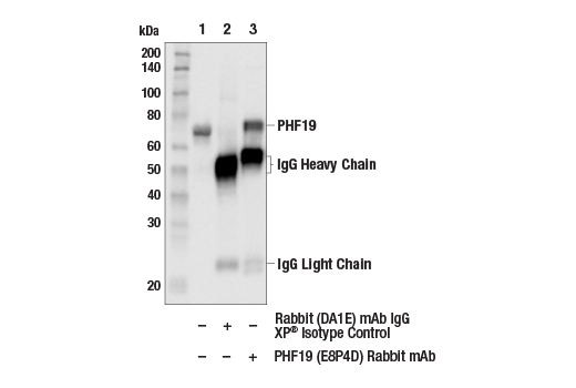 Immunoprecipitation Image 1: PHF19 (E8P4D) Rabbit Monoclonal Antibody