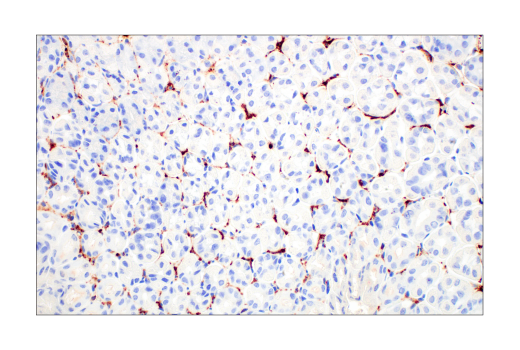 Immunohistochemistry Image 3: CD206/MRC1 (E6T5J) Rabbit Monoclonal Antibody