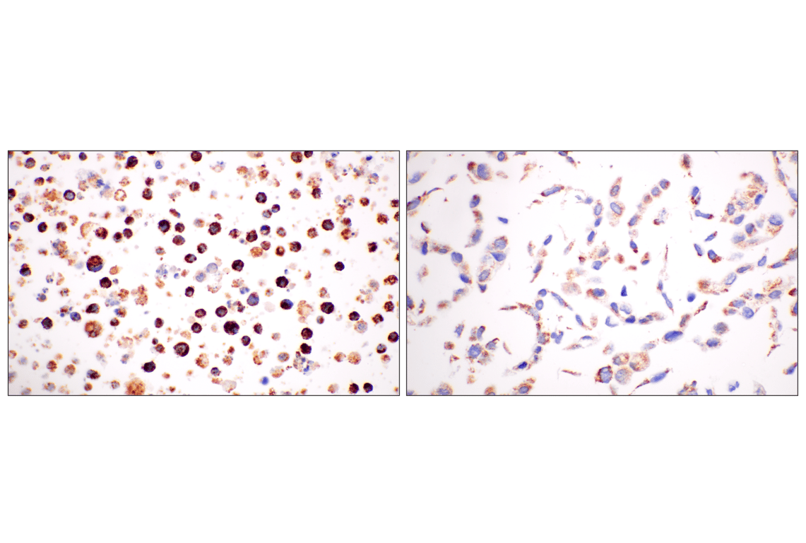 Immunohistochemistry Image 9: GCDH (F2P2M) Rabbit Monoclonal Antibody