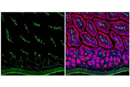 Immunofluorescence Image 2: Transgelin/TAGLN Antibody