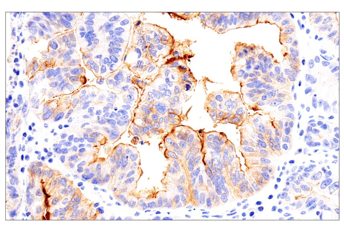 Immunohistochemistry Image 2: Folate Receptor Alpha/FOLR1 (BN3.2) Mouse Monoclonal Antibody