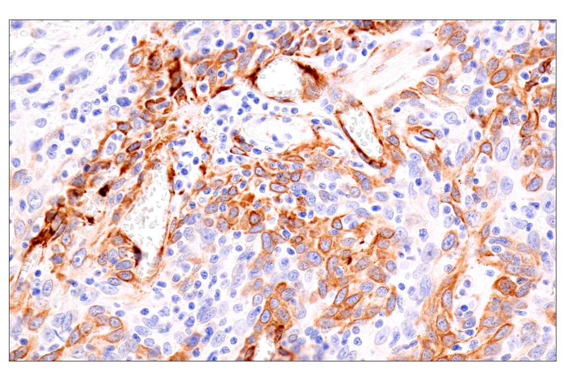 Immunohistochemistry Image 1: HSP47/SERPINH1 (E4A8P) Rabbit Monoclonal Antibody