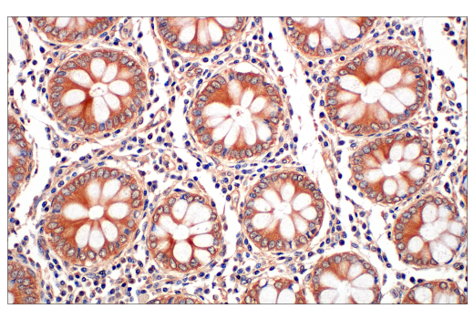 Immunohistochemistry Image 1: Ras (E8N8L) Rabbit Monoclonal Antibody (BSA and Azide Free)