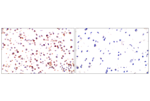 Immunohistochemistry Image 7: Neurofilament-M (E7Y8W) Mouse Monoclonal Antibody (BSA and Azide Free)