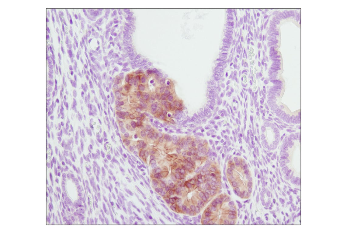 undefined Image 5: PhosphoPlus<sup>®</sup> Akt (Ser473) Antibody Duet