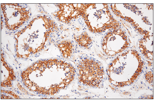 Immunohistochemistry Image 1: Nectin-2/CD112 (D8D3F) XP<sup>®</sup> Rabbit mAb (BSA and Azide Free)