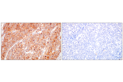 Immunohistochemistry Image 2: B-Raf (V600E Mutant) (IHC600) Mouse Monoclonal Antibody