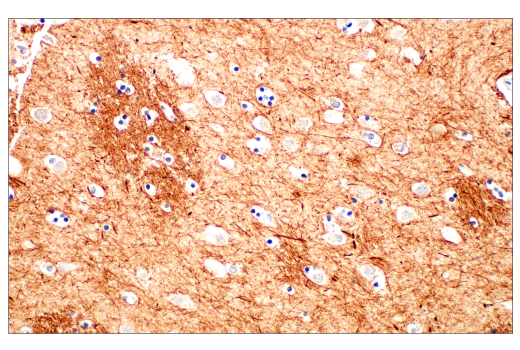 Immunohistochemistry Image 1: Neurofilament-M (E7Y8W) Mouse Monoclonal Antibody (BSA and Azide Free)