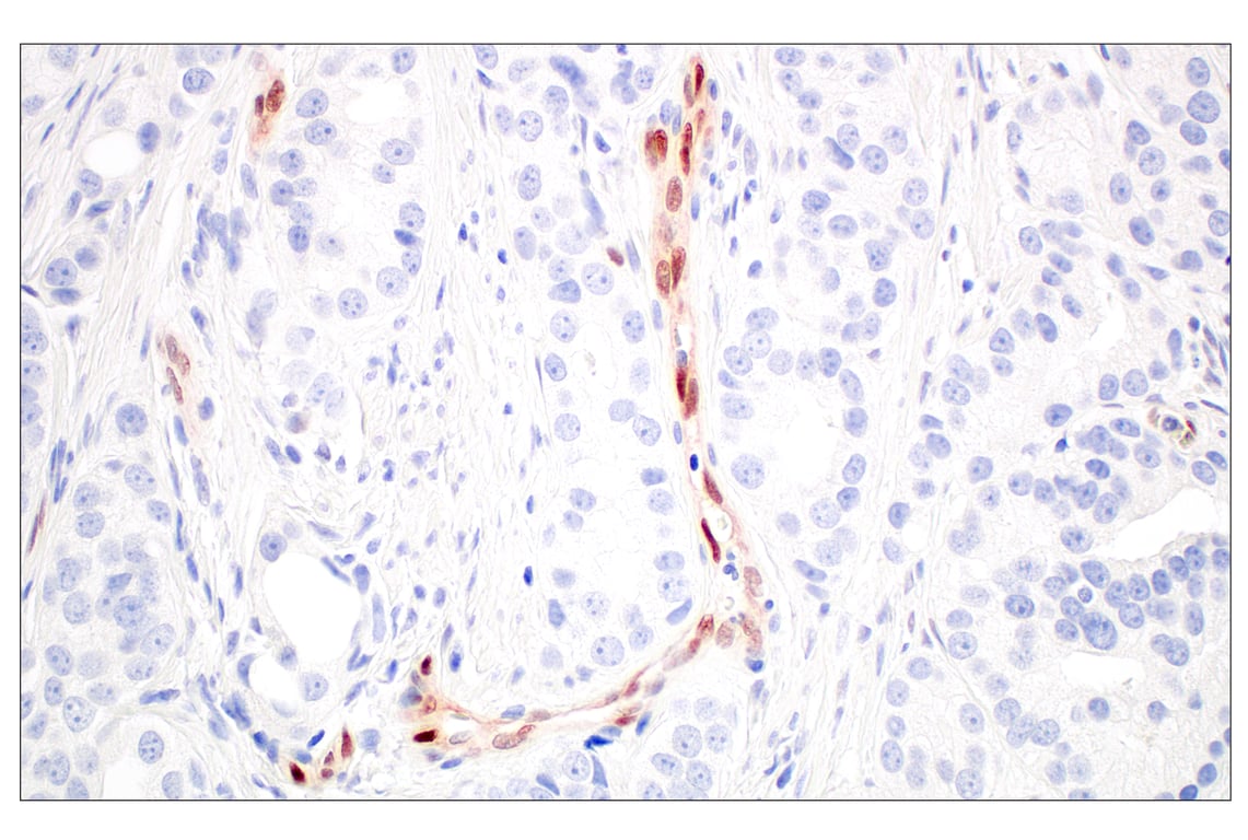 Immunohistochemistry Image 9: ARK5 (E4T2A) Rabbit Monoclonal Antibody
