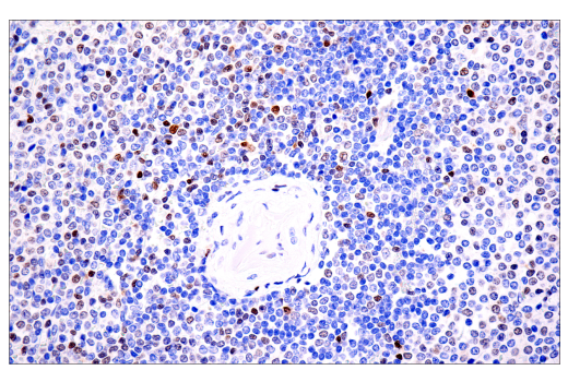 Immunohistochemistry Image 1: Tox/Tox2 (E6I3Q) Rabbit Monoclonal Antibody