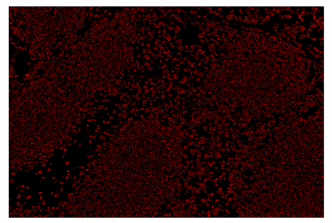 Immunohistochemistry Image 4: CD20 (E3N7O) & CO-0134-594 SignalStar<sup>™</sup> Oligo-Antibody Pair