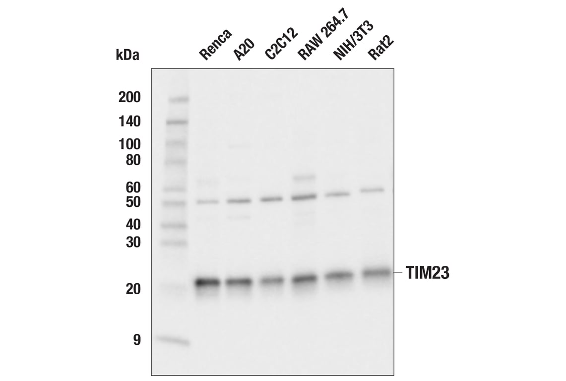 Western Blotting Image 3: TIM23 (E1Q7L) Rabbit Monoclonal Antibody