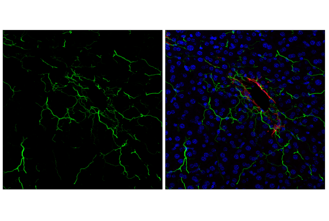 Immunofluorescence Image 3: COL1A1 (E8F4L) Rabbit Monoclonal Antibody