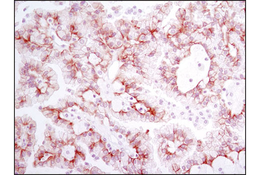 Immunohistochemistry Image 2: Met (D1C2) Rabbit Monoclonal Antibody (BSA and Azide Free)