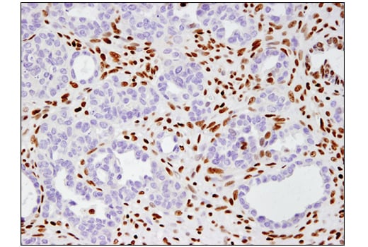 Immunohistochemistry Image 3: BRM (D9E8B) XP<sup>®</sup> Rabbit mAb