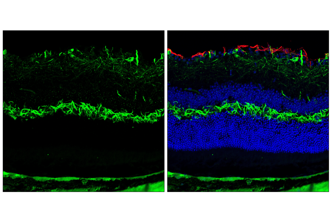 Immunofluorescence Image 3: Neurofilament-H (E9C9Z) Mouse Monoclonal Antibody