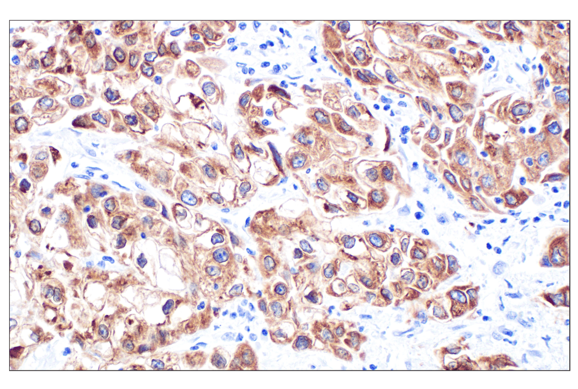 Immunohistochemistry Image 1: MGST1 (F6F5T) Rabbit Monoclonal Antibody