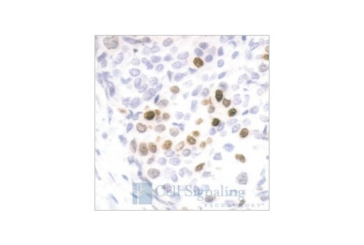Immunohistochemistry Image 1: Phospho-Histone H3 (Ser10) Antibody