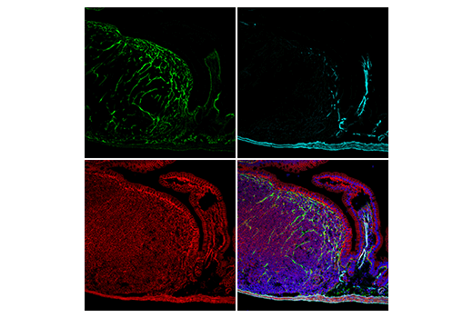 COL1A1 (E8F4L) XP® Rabbit mAb (Alexa Fluor® 488 Conjugate