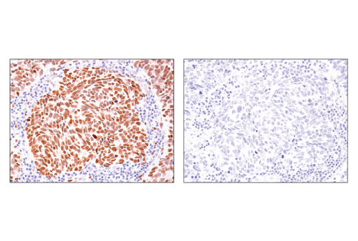 Immunohistochemistry Image 4: TEAD1 (D9X2L) Rabbit Monoclonal Antibody (BSA and Azide Free)
