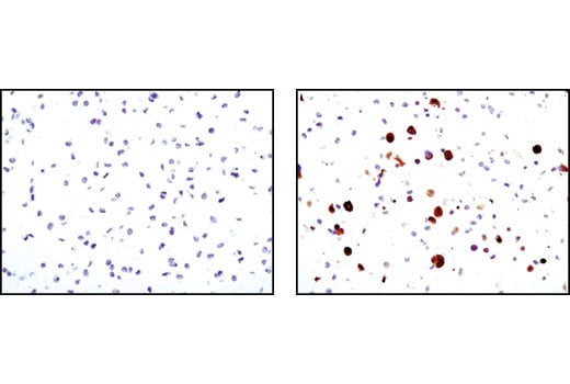Immunohistochemistry Image 1: SCD1 (C12H5) Rabbit Monoclonal Antibody