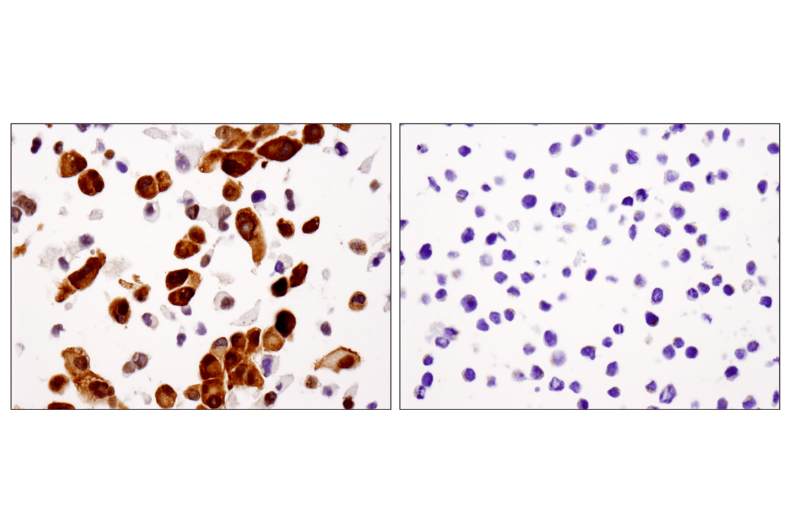 Immunohistochemistry Image 9: YAP (D8H1X) Rabbit Monoclonal Antibody