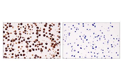 Immunohistochemistry Image 1: HLA-DRA (E9R2Q) XP<sup>®</sup> Rabbit mAb (BSA and Azide Free)