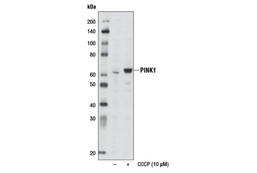 undefined Image 16: Mitophagy Antibody Sampler Kit