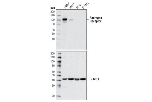 undefined Image 2: PhosphoPlus<sup>®</sup> Androgen Receptor (Ser258) Antibody Duet