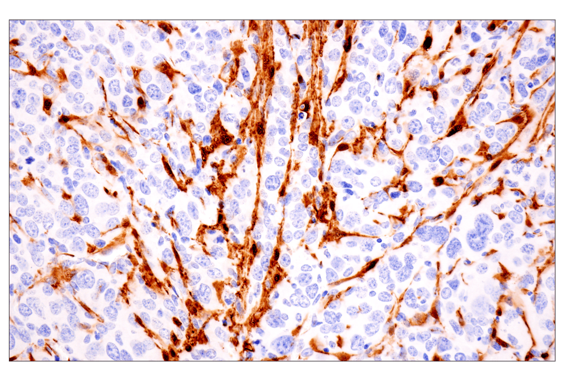 Immunohistochemistry Image 12: Transgelin/TAGLN (F3B7H) Rabbit Monoclonal Antibody