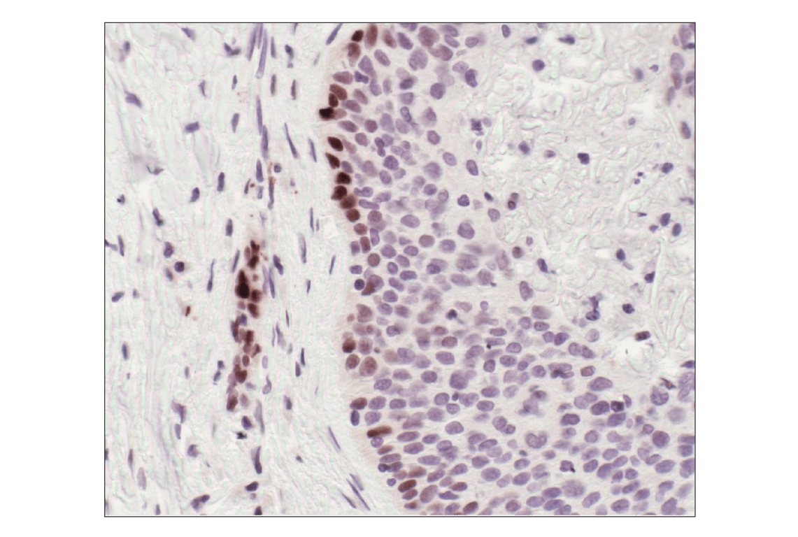 Immunohistochemistry Image 2: Phospho-Stat3 (Tyr705) (D3A7) Rabbit Monoclonal Antibody