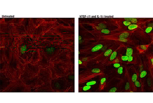Immunofluorescence Image 1: HMGA2 (D1A7) Rabbit Monoclonal Antibody