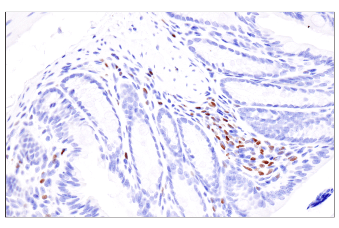 Immunohistochemistry Image 6: Ikaros (D6N9Y) Rabbit Monoclonal Antibody