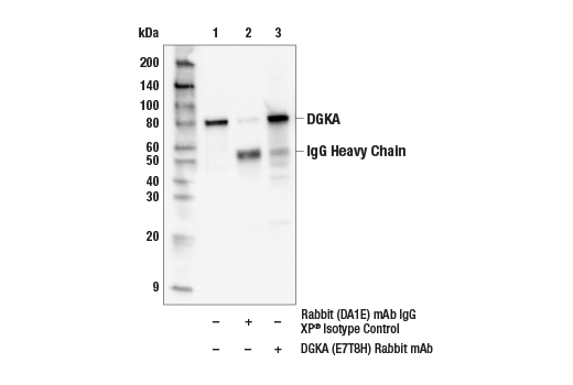 Immunoprecipitation Image 1: DGK alpha (E7T8H) Rabbit Monoclonal Antibody
