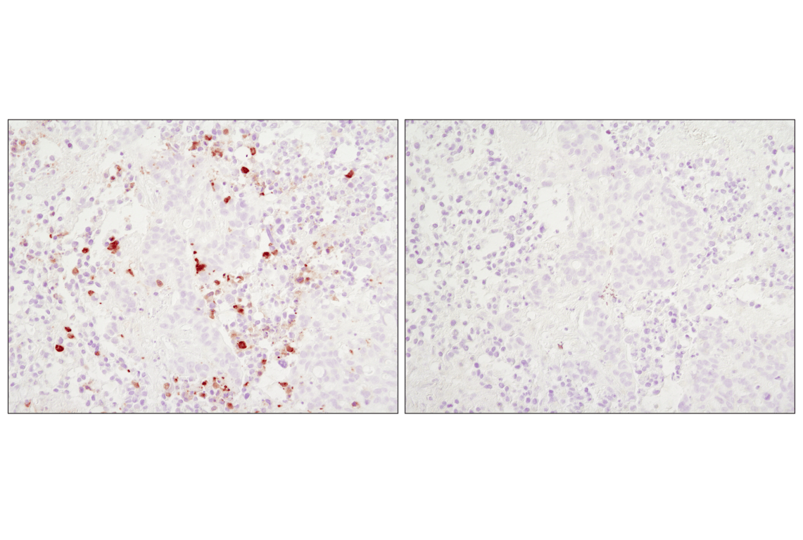 Immunohistochemistry Image 4: Cleaved Caspase-3 (Asp175) (D3E9) Rabbit Monoclonal Antibody (BSA and Azide Free)