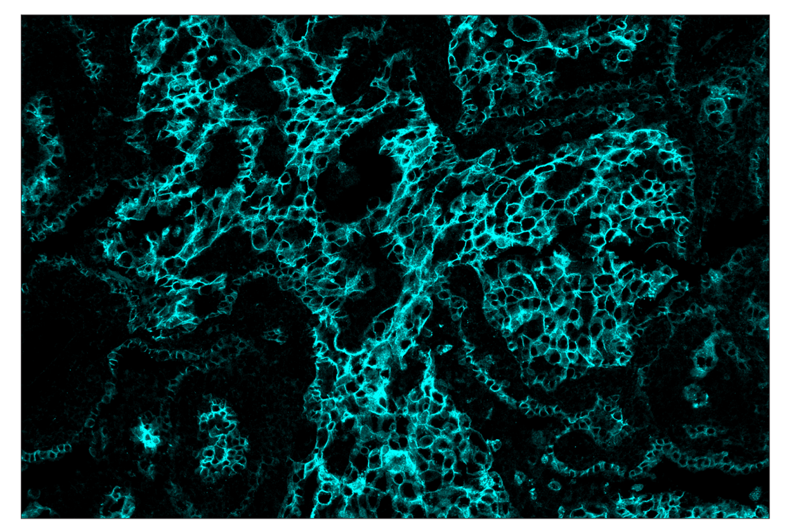 Immunohistochemistry Image 5: HER2/ErbB2 (D8F12) & CO-0059-647 SignalStar<sup>™</sup> Oligo-Antibody Pair