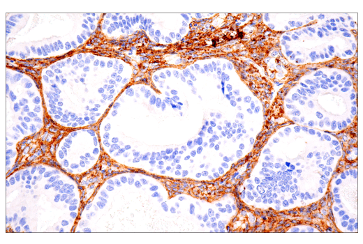 Immunohistochemistry Image 1: COL1A1 (E8F4L) Rabbit Monoclonal Antibody