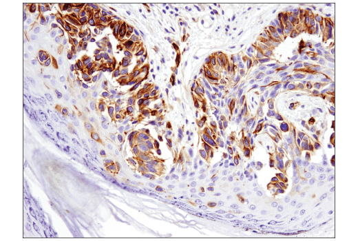 Immunohistochemistry Image 4: Nestin (10C2) Mouse Monoclonal Antibody