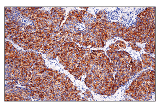 Immunohistochemistry Image 1: DLL3 (E3J5R) Rabbit mAb